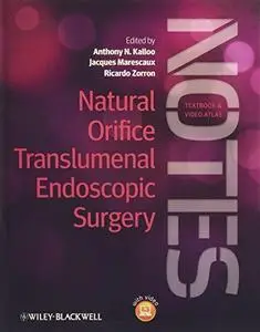 Natural Orifice Translumenal Endoscopic Surgery (NOTES) (Repost)