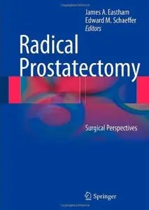 Radical Prostatectomy: Surgical Perspectives [Repost]