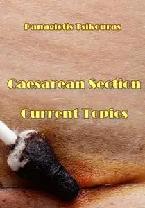 "Caesarean Section Current Topics" ed. by Panagiotis Tsikouras, Nikolaos Nikolettos, Werner Rath