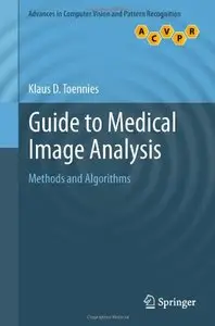 Guide to Medical Image Analysis: Methods and Algorithms (repost)