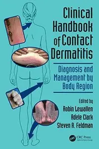 Clinical Handbook of Contact Dermatitis: Diagnosis and Management by Body Region (repost)