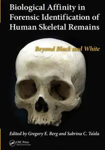 Biological Affinity in Forensic Identification of Human Skeletal Remains Beyond Black and White