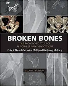 Broken Bones: The Radiologic Atlas of Fractures and Dislocations, 2nd Edition