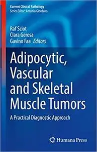 Adipocytic, Vascular and Skeletal Muscle Tumors: A Practical Diagnostic Approach (Current Clinical Pathology)