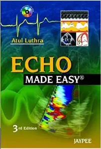 Echo Made Easy (3rd Edition)