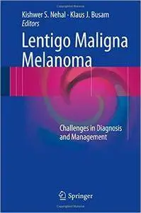 Lentigo Maligna Melanoma: Challenges in Diagnosis and Management