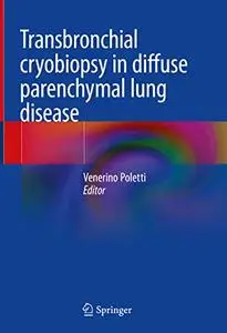 Transbronchial cryobiopsy in diffuse parenchymal lung disease (Repost)