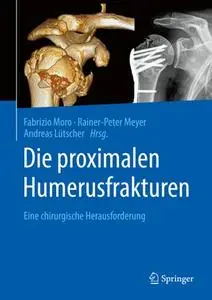 Die proximalen Humerusfrakturen: Eine chirurgische Herausforderung (Repost)