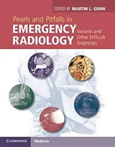 Pearls and Pitfalls in Emergency Radiology Variants and Other Difficult Diagnoses