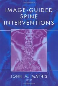 Image-Guided Spine Interventions by John M. Mathis