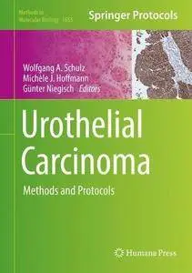 Urothelial Carcinoma: Methods and Protocols (Methods in Molecular Biology)