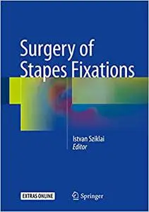 Surgery of Stapes Fixations (Repost)