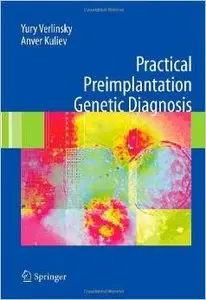 Practical Preimplantation Genetic Diagnosis by Anver Kuliev