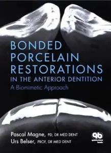 Bonded Porcelain Restorations in the Anterior Dentition: A Biomimetic Approach
