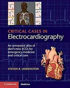 Critical Cases in Electrocardiography: An Annotated Atlas of Don't-Miss ECGs for Emergency and Critical Care