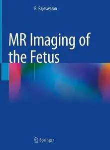 MR Imaging of the Fetus (Repost)