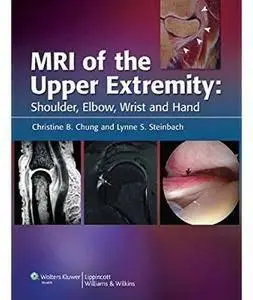 MRI of the Upper Extremity: Shoulder, Elbow, Wrist and Hand [Repost]