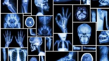 Let'S Master X-Rays
