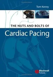 Nuts and Bolts of Cardiac Pacing