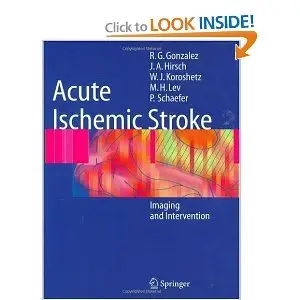 Acute Ischemic Stroke: Imaging and Intervention (Repost)