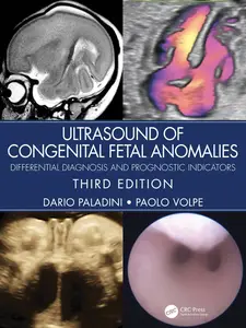 Ultrasound of Congenital Fetal Anomalies: Differential Diagnosis and Prognostic Indicators, 3rd Edition