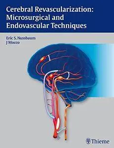 Cerebral Revascularization: Microsurgical and Endovascular Techniques