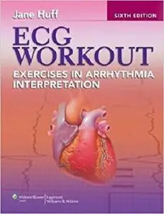 ECG Workout: Exercises in Arrhythmia Interpretation [Repost]