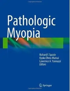 Pathologic Myopia