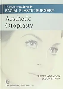 Aesthetic Otoplasty