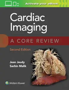 Cardiac Imaging: A Core Review (2nd Edition)