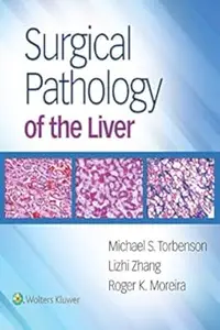 Surgical Pathology of the Liver (Repost)