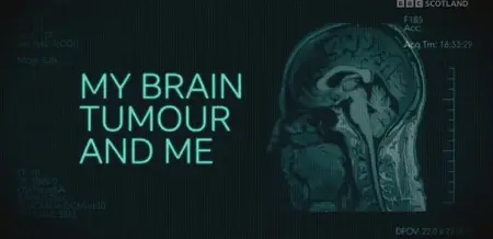 BBC - My Brain Tumour and Me (2024)