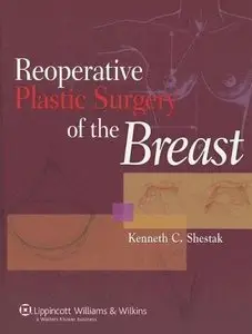 Reoperative Plastic Surgery of the Breast (repost)