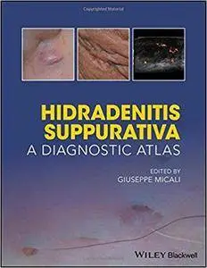 Hidradenitis Suppurativa: A Diagnostic Atlas