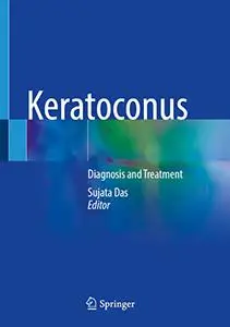 Keratoconus: Diagnosis and Treatment