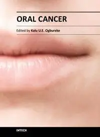 Oral Cancer by Kalu U. E. Ogbureke