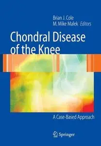 Chondral Disease of the Knee: A Case-Based Approach by Brian J. Cole