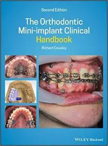 The Orthodontic Mini-implant Clinical Handbook