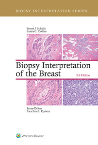 Biopsy Interpretation of the Breast, 3rd Edition