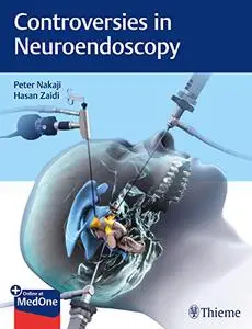 Controversies in Neuroendoscopy