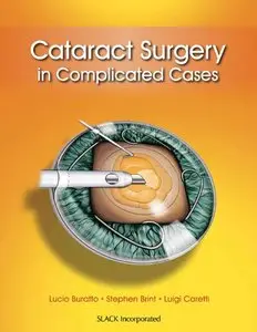 Cataract Surgery in Complicated Cases (repost)