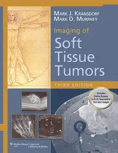 Imaging of Soft Tissue Tumors