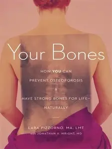 Your Bones: How You Can Prevent Osteoporosis and Have Strong Bones for Life - Naturally (repost)