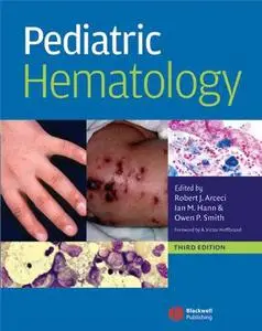 Pediatric Hematology, Third Edition