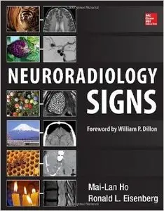 Neuroradiology Signs