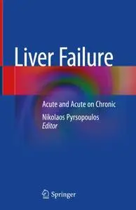 Liver Failure; Acute and Acute on Chronic