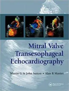 Mitral Valve Transesophageal Echocardiography (Repost)