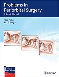 Problems in Periorbital Surgery: A Repair Manual