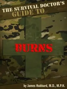 The Survival Doctor's Guide to Burns: What to Do When There Is No Doctor