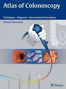 Atlas of Colonoscopy: Techniques - Diagnosis - Interventional Procedures (Repost)